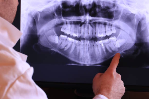 Best Urgent Tooth Repair  in Badieville, LA