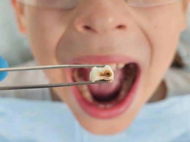 Best Tooth Pain Emergency Relief  in Badieville, LA