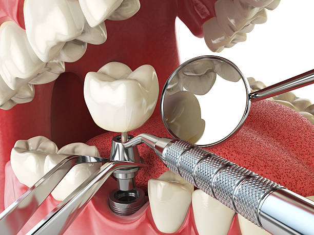 Best Tooth Pain Emergency Relief  in Badieville, LA